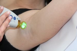 Interview mit Claudia Hatzl von Laser Ästhetik am Tegernsee über dauerhafte Haarentfernung