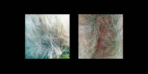 Vielfalt der Vulva: Das Tor ins Leben